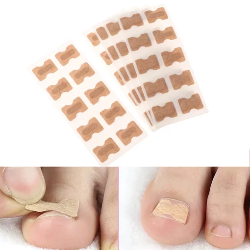 Corretor de unha do dedo do pé (pacote de 30)