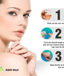 Medical Soft Silicone Gel Tape For Scar Removal