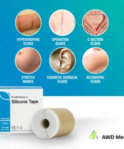 Medical Soft Silicone Gel Tape For Scar Removal