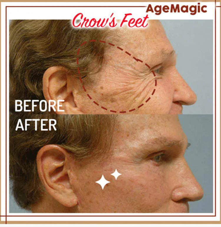 New Retinol Anti Aging Face Essence - Image 2