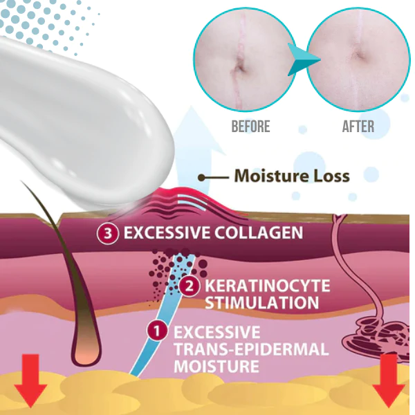 SkinFx™ Scar & Acne Bump Removal Cream - Image 3