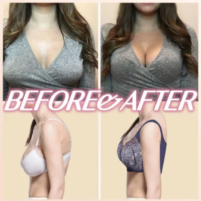 Lymphvity Detoxification and Shaping & Powerful Lifting Bra - Buy