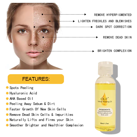 OLF™ Natural Spots Whitening Yellow Peeling Oil (50ml, 1.7oz) - Image 5