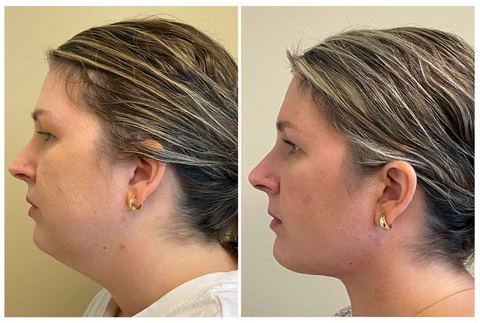 OdorFit Aromatherapy Detox Breathe Stick - Image 7