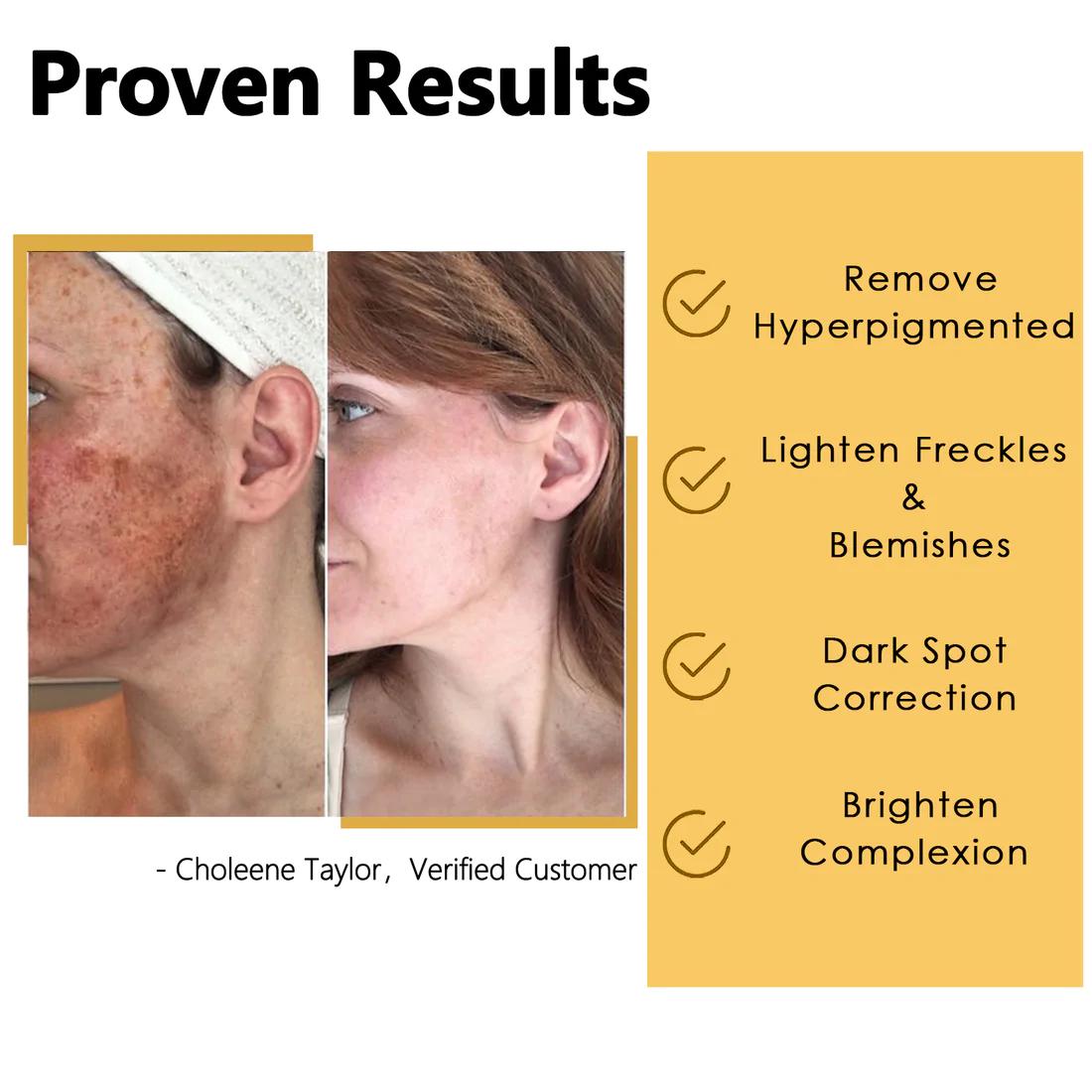 OLF™ Natural Spots Whitening Yellow Peeling Oil (50ml, 1.7oz) - Image 2