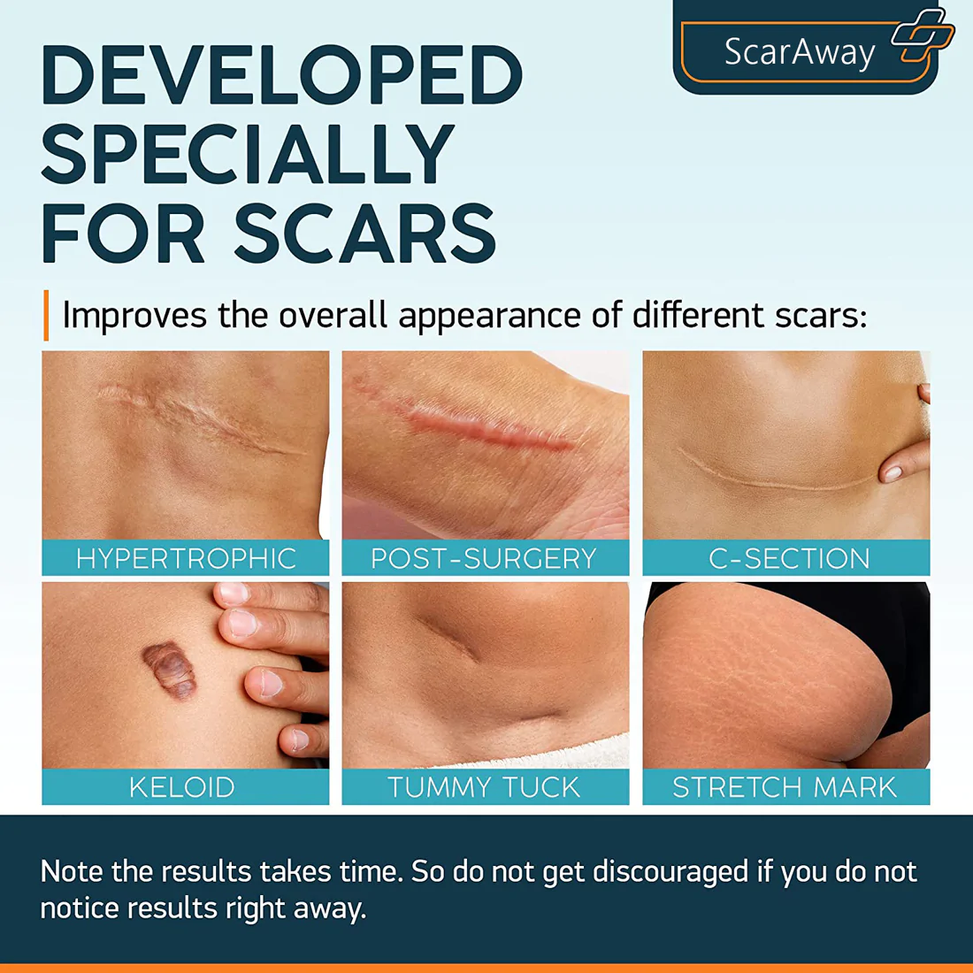 ScarAway®100% Advanced Scar Gel ,C-Section, Tummy Tuck, Old Scars, Keloids, Stretch Marks, Burn Scars. - Image 2