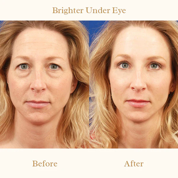 Derm+ Peptide Eye Cream Pro - Image 8