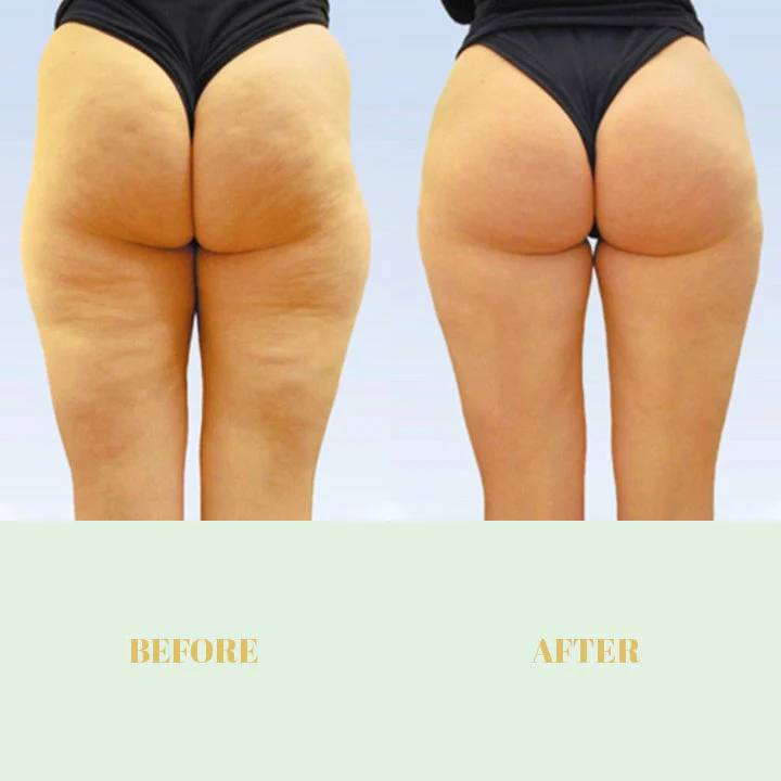 ButtUp™ Hip Lifting Essential Oil - Image 8