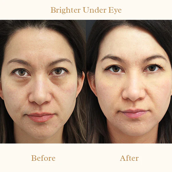 Derm+ Peptide Eye Cream Pro - Image 9