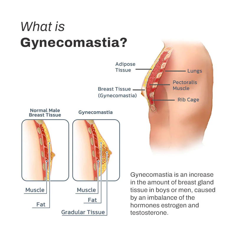 ChestUp GynoBurn AntiCellulite HeatingBalm - Image 7