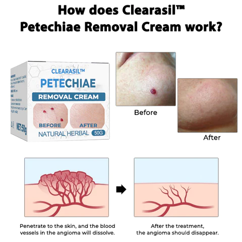 Clearasil™ Petechiae Removal Cream - Image 5