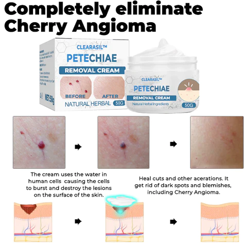Clearasil™ Petechiae Removal Cream - Image 6