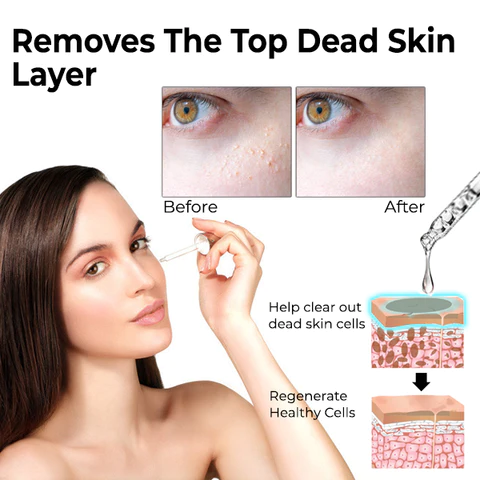 DermaPRO Speedy Milia Remover - Image 6