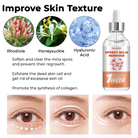 DermaPRO Speedy Milia Remover - Image 7