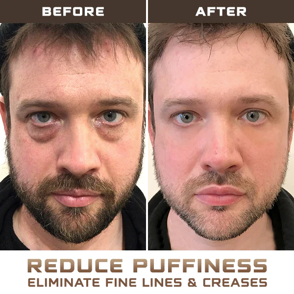 Eyesentials™ Ultra Hydrating Eye Roller - Image 4