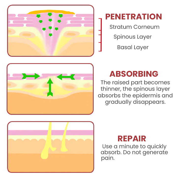 HOLO Medical Wart Removal Cream - Image 3