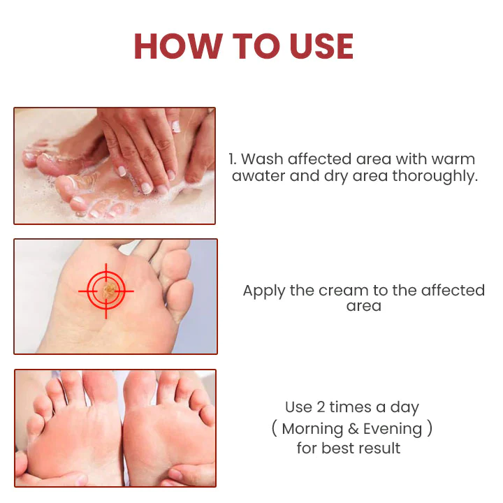 HOLO Medical Wart Removal Cream - Image 7