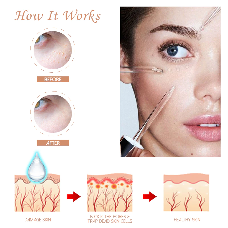 HerbPRO Milia FatGranules Reduce Serum - Image 2