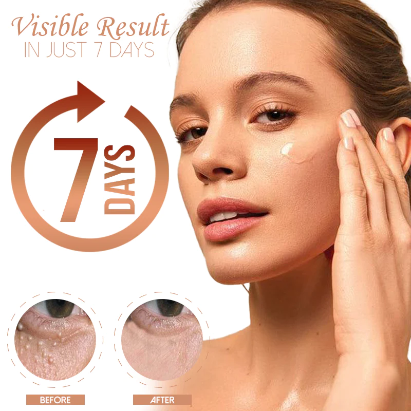 HerbPRO Milia FatGranules Reduce Serum - Image 3