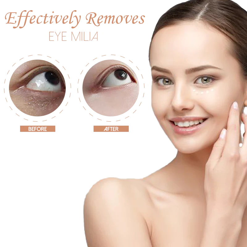 HerbPRO Milia FatGranules Reduce Serum - Image 8