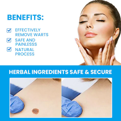 Instant Wart Removal Ointment - Image 5