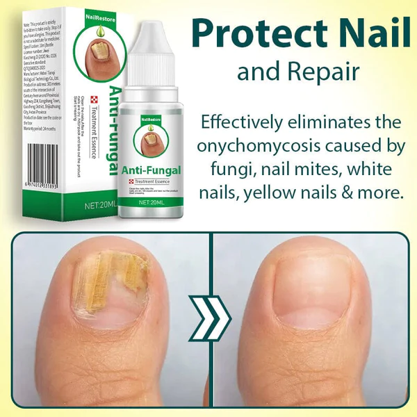 NailRestore Anti-Fungal Treatment Essence - Image 4