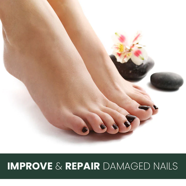 LifeMed Home Use Onychomycosis Fungal Laser Treatment - Image 6