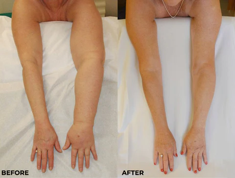 RochFit™ Lymph Detoxification Ginger Oil - Image 2