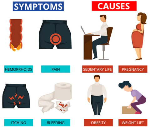 HemRelief Hemorrhoid & Fissure Cream - Image 5