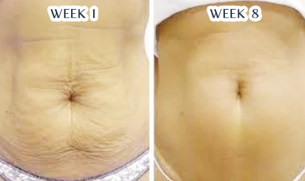 JUENIX VITALITY Anti-Cellulite Pump-Serum - Image 7