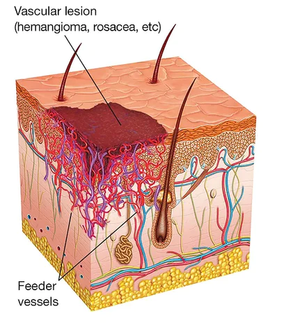 Clearasil™ Petechiae Removal Cream - Image 4