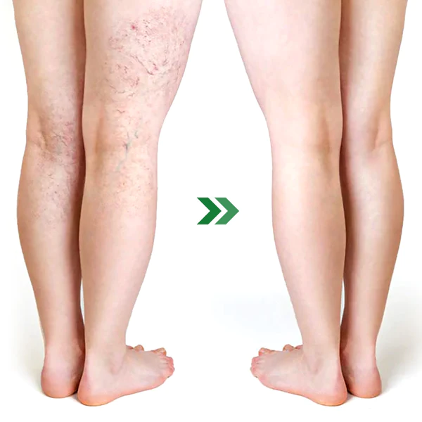 GFOUK™ NatureHeal Wormwood Purifying Pads - Image 6