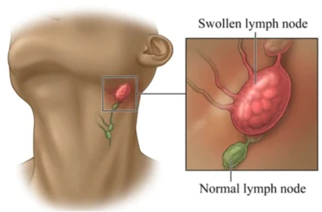 RochFit™ Lymph Detoxification Ginger Oil - Image 4