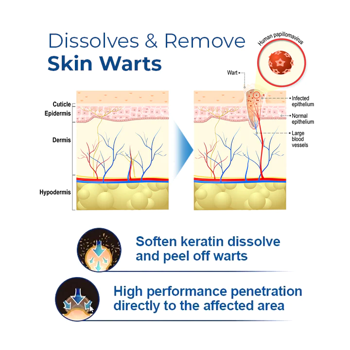 MEDix™ Wart-Off Cream - Image 7