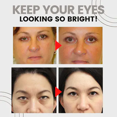 FlipBeauty™ Enhancing Eye Lift Serum - Image 2