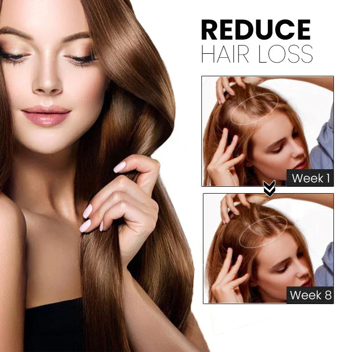 RAYCON ™ Hair Growth Vitalizer - Image 5