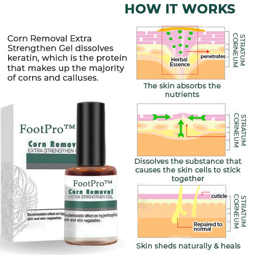 FootPro™ Corn Removal Extra Strengthen Gel(Limited time discount 🔥 last day) - Image 6