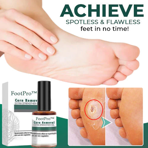 FootPro™ Corn Removal Extra Strengthen Gel(Limited time discount 🔥 last day) - Image 2