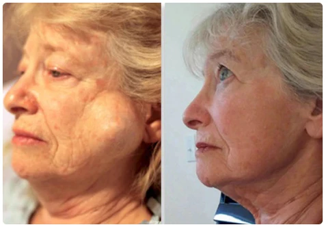 RochFit™ Lymph Detoxification Ginger Oil - Image 3