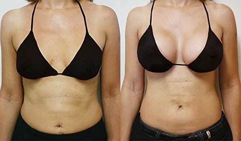 NatureUp™ Breast Plumping&Firming Cream - Image 6