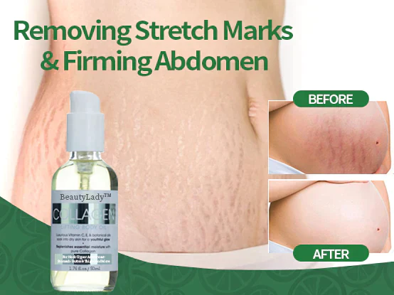 BeautyLady™ Collagen Lifting & Whitening Body Oil - Image 7