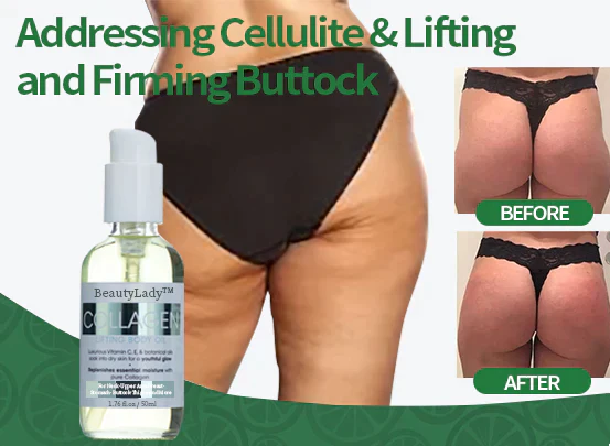 BeautyLady® Collagen Lifting Body Oil - Image 6