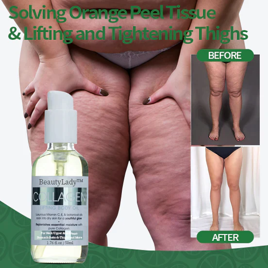 BeautyLady™ Collagen Lifting & Whitening Body Oil - Image 5