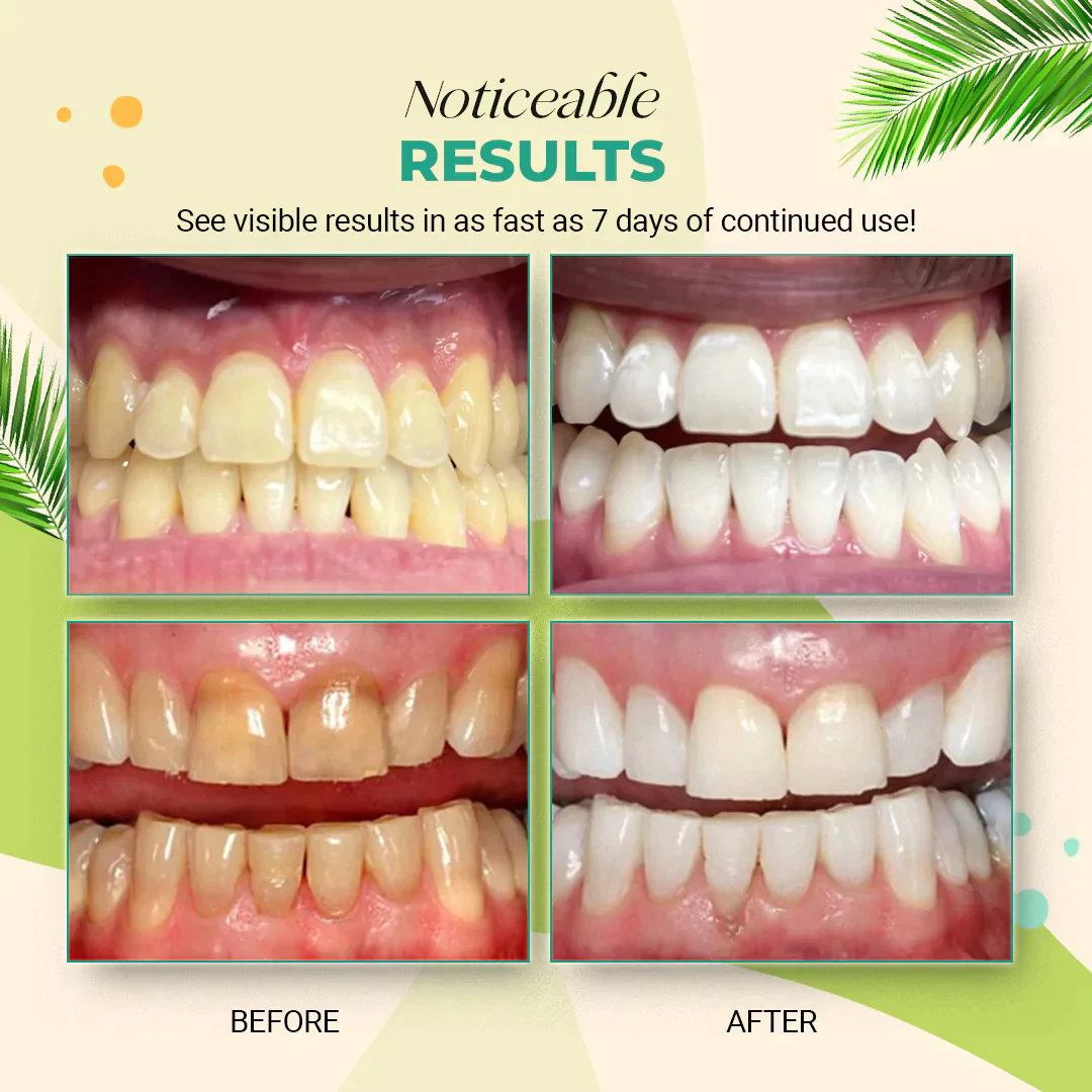 Coconut Oil Teeth Whitening Strips - Image 7
