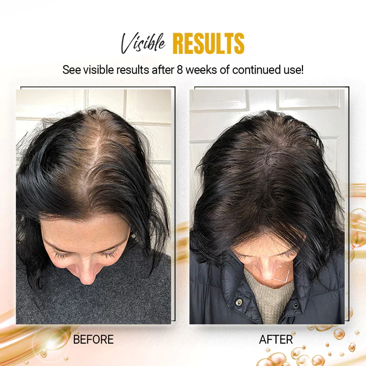 KuseScene™ Japanese Rice Water Hair SerumMist - Image 9