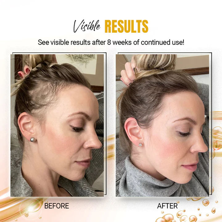 KuseScene™ Japanese Rice Water Hair SerumMist - Image 10