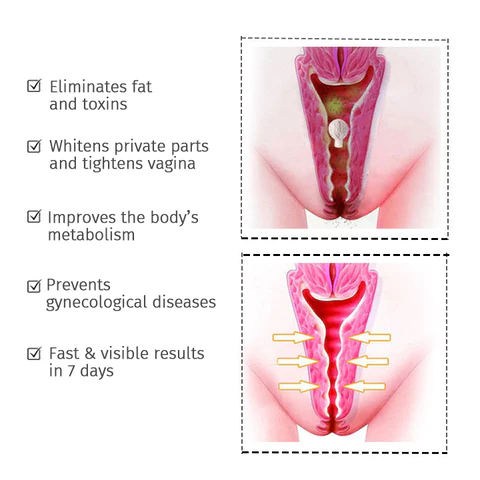 iNature® Yoni Herbal Detox Pearls Tampons - Image 8