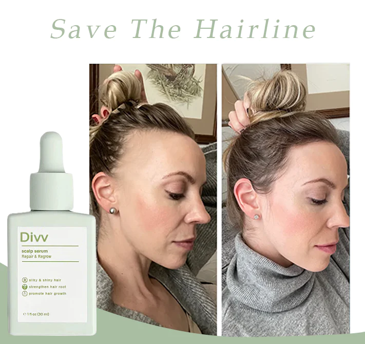 Divi™ Scalp Serum - Repair & Regrow - Image 3