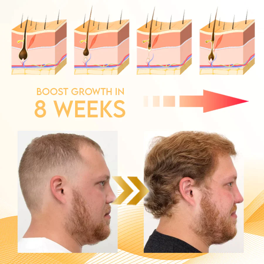 Luxonix Hair Nutrition Regrowth Spray - Image 5