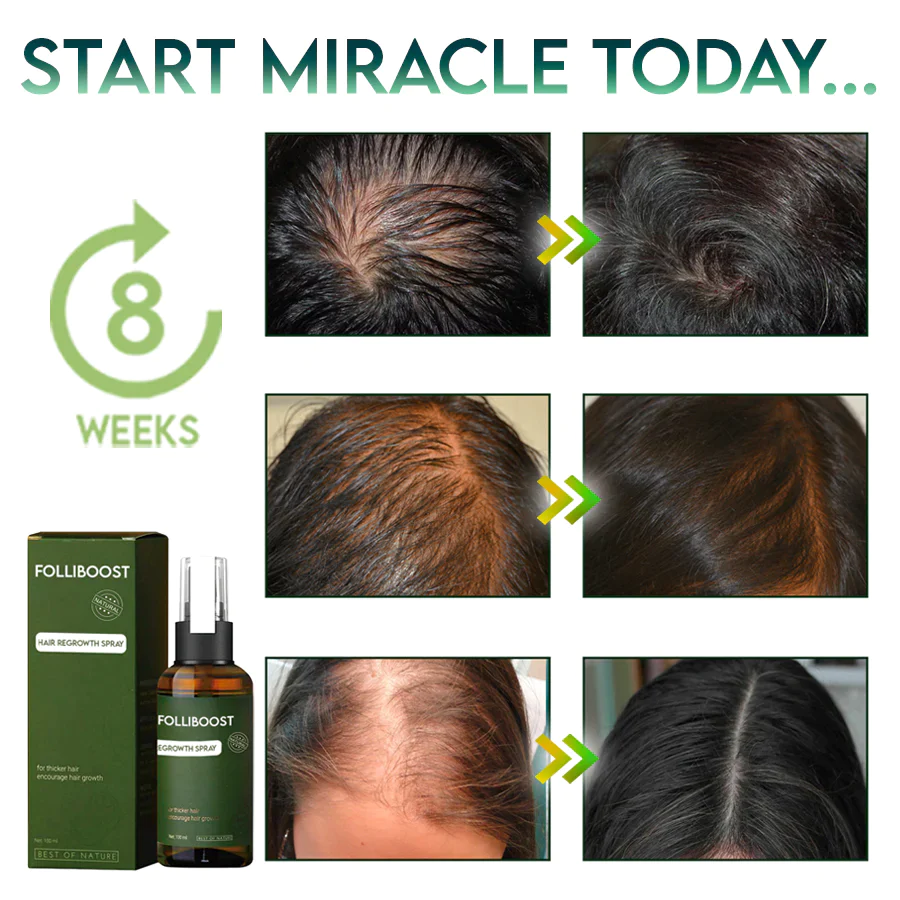 FolliBoost Hair Regrowth Spray - Image 6
